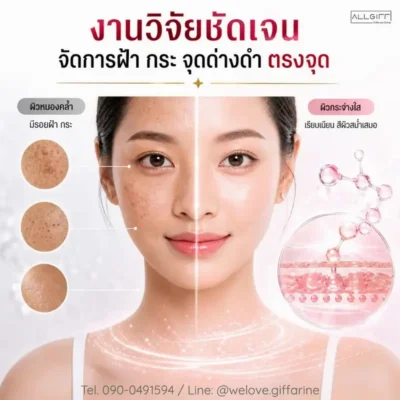 ผลลัพธ์กิฟฟารีน เมลาโปร ลดเลือนฝ้า กระ จุดด่างดำ อย่างตรงจุด ผิวเรียบเนียน สีผิวสม่ำเสมอขึ้น แสดงการเปรียบเทียบก่อนและหลังใช้