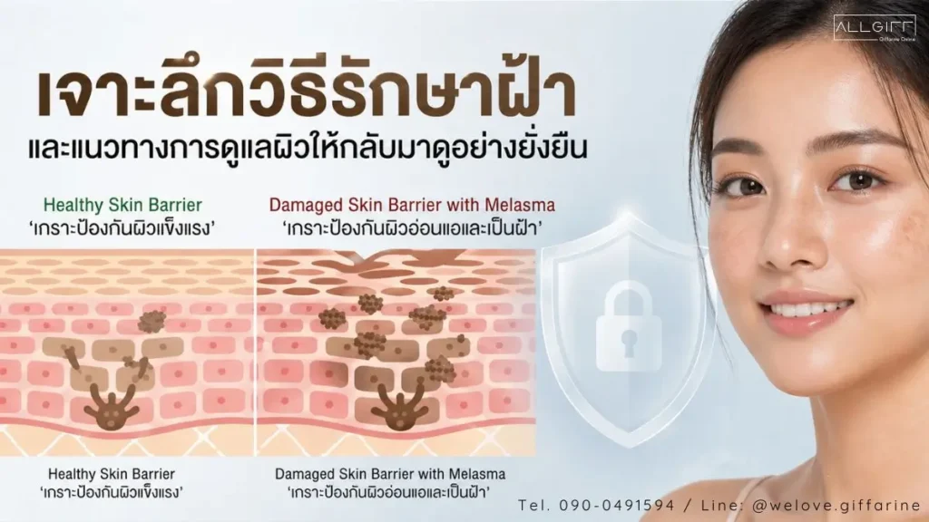 แนวทางและ วิธีรักษาฝ้า ด้วยการฟื้นฟูเกราะป้องกันผิว Skin Barrier ให้แข็งแรงอย่างยั่งยืน