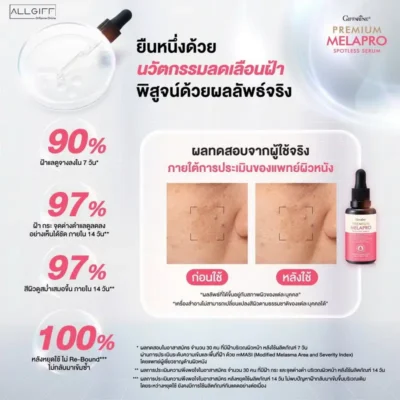 ภาพผลลัพธ์ Before-After เปรียบเทียบผิวหน้าก่อนและหลังใช้กิฟฟารีน พรีเมียม เมลาโปร เซรั่ม สปอตเลส พร้อมตัวเลขผลทดสอบจริง ฝ้าจางลง 90% ใน 7 วัน และไม่กลับมาเข้มซ้ำ 100%