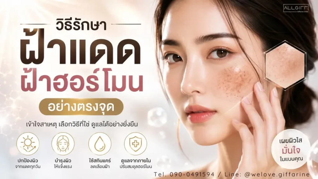 วิธีรักษาฝ้าแดด ฝ้าฮอร์โมน อย่างตรงจุด เข้าใจสาเหตุ เลือกวิธีที่ใช่ ดูแลผิวได้อย่างยั่งยืน