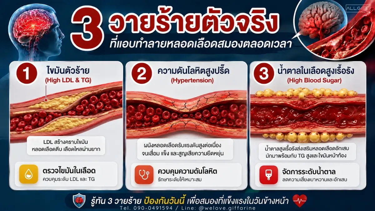 อินโฟกราฟิก 3 วายร้ายทำลายหลอดเลือดสมอง ได้แก่ ไขมันในเลือดสูง ความดันโลหิตสูง และน้ำตาลในเลือดสูงเรื้อรัง สาเหตุโรคหลอดเลือดสมอง